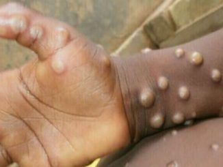 global health emergency